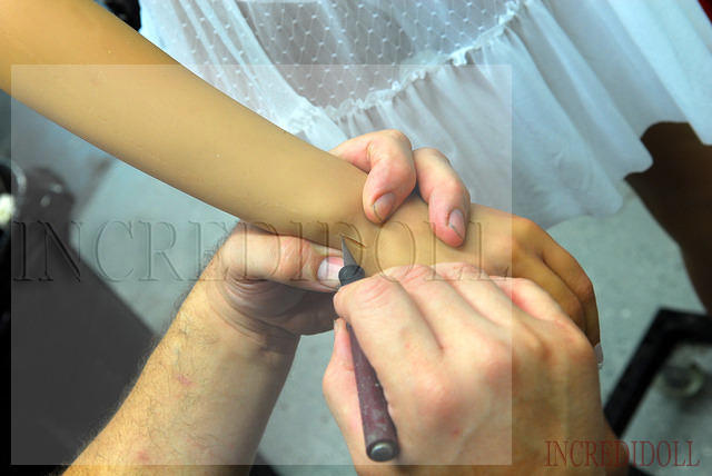 Wrist Repair (10b)