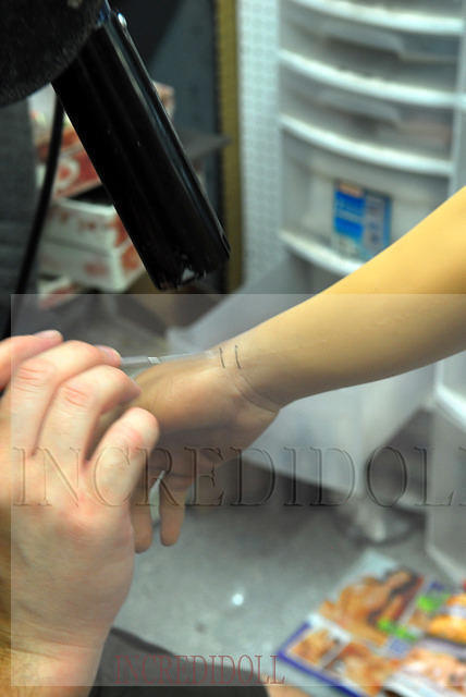 Wrist Repair (41b)