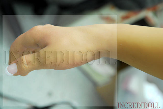 Wrist Repair (42b)